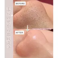 毛穴洗浄フェイシャル&PDRNサーモンDNA美白液導入