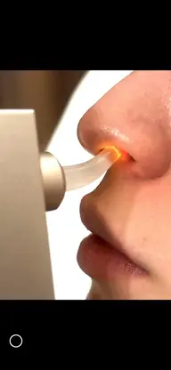 鼻毛脱毛