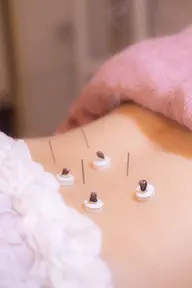 お試し婦人科鍼灸🌷