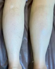 【脚フルWAX脱毛】脚の付け根​〜​指先まで