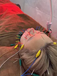 全身鍼×美容鍼プレミアム👑パルス,マッサージ付き