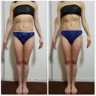 PRセル&ラジオ波60分コース