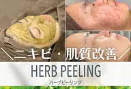今だけ限定50%off❣️【お試しWハーブピーリング+肌チェック🌿90分¥9900】ニキビ/毛穴/肌質改善/くすみ