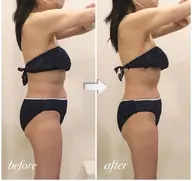 【人気NO.1★中四国1台のみ】即日結果！スピード痩身で本気痩せ！