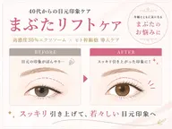 当サロン人気メニュー！まぶたリフト★お目元の症例写真にご協力いただける方募集中！※お目元に老化を感じる40代​〜​50代の方
