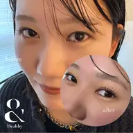 【人気No. 1コース🌼】&healthy(マツエク120本➕まつ毛パーマ)9900円🩵(5名限定/オフ込)