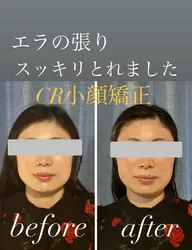 人気No. 1✨骨格整体×小顔リフトアップ×バストアップ❣️(セット)