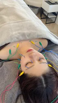 🌟初回65%OFF🌟トライアル美容鍼🪡✨むくみスッキリ‼️眼精疲労もツヤ肌も目指せる☝🏻💕