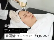 【全ての肌悩みに◎】最先端エステ版ポテンツァ！毛穴/お肌の凹凸/トラブル肌/エイジングケア/長年の赤みに対応