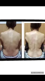 キャンペーン🔥ウエストくびれ、お腹ポッコリ撃退✨@新宿御苑前駅の系列店にて⭐️1ヶ月以内に2回施術分