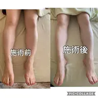 足痩せフットリンパ&ドライヘッドスパ