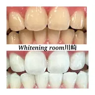 【ミニモ学割】学生限定★ セルフホワイトニング30分照射×3回コース　回数券🦷💎