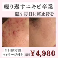 【当日限定】隠す毎日を終わらせたい方へ｜ニキビ跡・凹凸肌専用ケア ¥4,980(ヘッドマッサージ付)