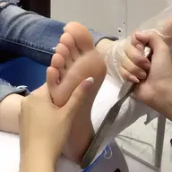 フット角質除去