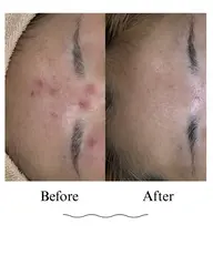 すっぴんでも怖くない肌作り