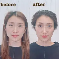 【期間限定】✨骨格補正ヘッドスパ モニター様募集✨