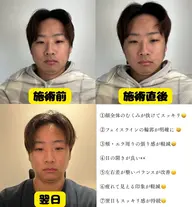 【フェイス】疲れ顔/垂れ下がり顔リセットコース【筋膜リリース】