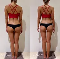 【足痩せ🦵🏻痩身ダイエットメニュー】ラジオ波キャビテーションで浮腫みを除去✨骨盤矯正/ヒップアップしたい方にオススメ