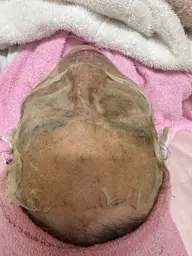 毛穴洗浄•ハーブトリートメント•パック