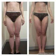 春夏に向けて👗即効痩せ✨《全身痩身ハイパーナイフ✖️強力デトックスマッサージ🔥》