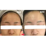 U25限定! 学割プラン(エステ3回分+ハイドロパック2回分付き✨)