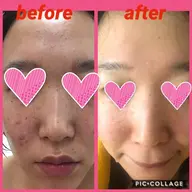 🌟痩身+透明感ある美肌へ🌟🌿全身リンパマッサージ+ruruonn+引き締め小顔マッサージ+美容液たっぷりパック❤️