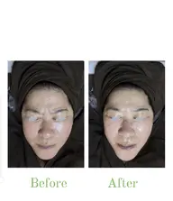 🕊シミ解消透明感up🕊美白も毛穴もひきしめも‼️