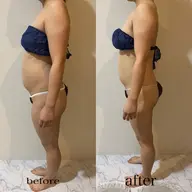 県内初導入✨効果すごい！キャビテーション痩せたい方必見