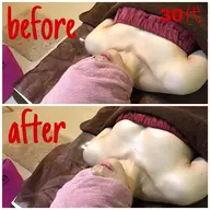 【新規限定】コンプレックス解消！バストアップコース