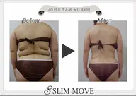 スリムムーブ全身90分