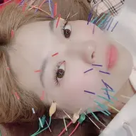 🌸当院お勧め美容鍼✨鍼(うつ伏せ)＋美容鍼(仰向け)＋頭皮鍼＋パルス（電気鍼:顔）＋マッサージ