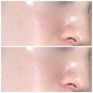 【韓国肌管理✨️最新第四世代ピーリング】 ララピール￥9300