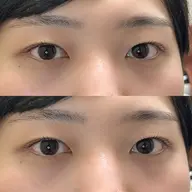 逆さまつ毛解消ナチュラルに目力up🍀* ゚メンズまつ毛パーマ💙(土日祝➕￥550）