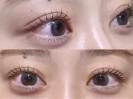 『minimo限定価格』小顔効果💞上下ラッシュリフト