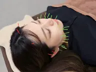 【ご新規様】🔸美容鍼×整体×小顔矯正🔸で美容鍼の効果を最大限に✨　　　　　　　　　　　　　　　　〈70分〉