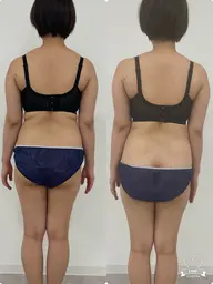 ブライダルエステ上半身コース