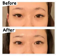 【目の疲れ・クマ】目元たるみケアコース💆🏼♀️