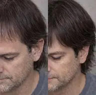 【男性限定】M字・生え際改善✨LEDエクステ体験／自然仕上げ