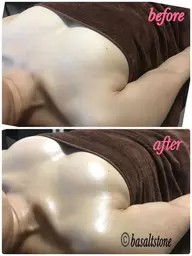 今だからこそキャンペーン❣️バザルト®︎ストーン使用❣️ブライダルエステ💆🏻‍♀️