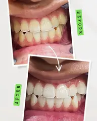 【本気で白くしたい人に絶対オススメ】通い放題プラン（月額¥11,000）