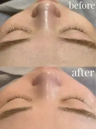 【透明感UP✨ツヤツヤ肌へ】フルフェイシャルワックス