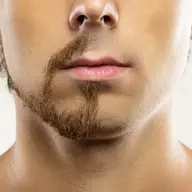 メンズヒゲ脱毛