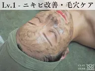 【学割U24】剥離ありハーブピーリング[剥離なし約10回分の効果]¥25,175