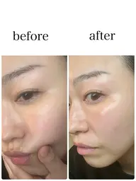 【本気の美白エイジングケア】プラピール＋グルタチオン導入のセットで透明感アップ↑↑