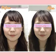 【📷小顔モニター募集中】周りから憧れられる小顔へ☆美容 小顔矯正　30分