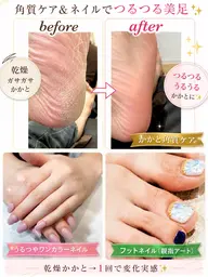 ✨ハンドカラー✖️フットカラー✖︎角質ケア付き✨