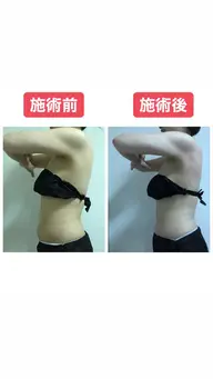 【痩身モデル】※写真OKな方　先着10名様60分コース5回通常60000円→40000円※1ヶ月で通える方限定