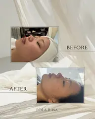 【ごわつき、乾燥、透明感🌼】フェイシャル、プチデコルテエステ💆‍♀️🫧ྀིプレゼント付き🧹