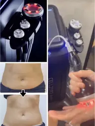 ［手でマッサージ＋最新マシン♪超音波×ラジオ波RFボディケア］マシン70分￥10000→￥8000