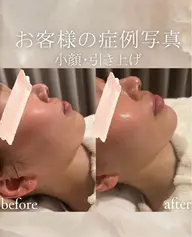 【平日18時​〜​】仕事終わりのお疲れ肌をリセット☆エイジングケアフェイシャル🌟